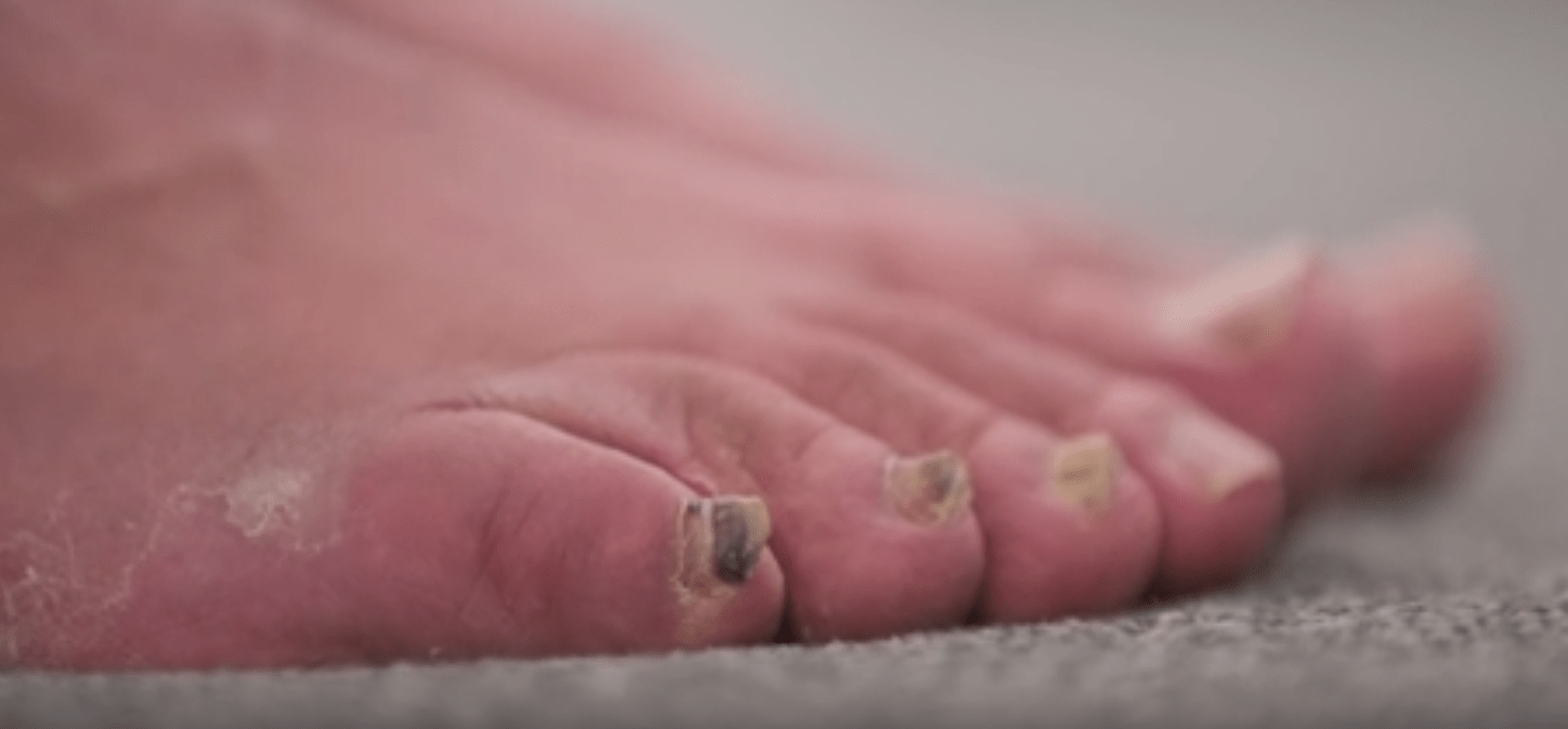 The Bad Foot Clinic