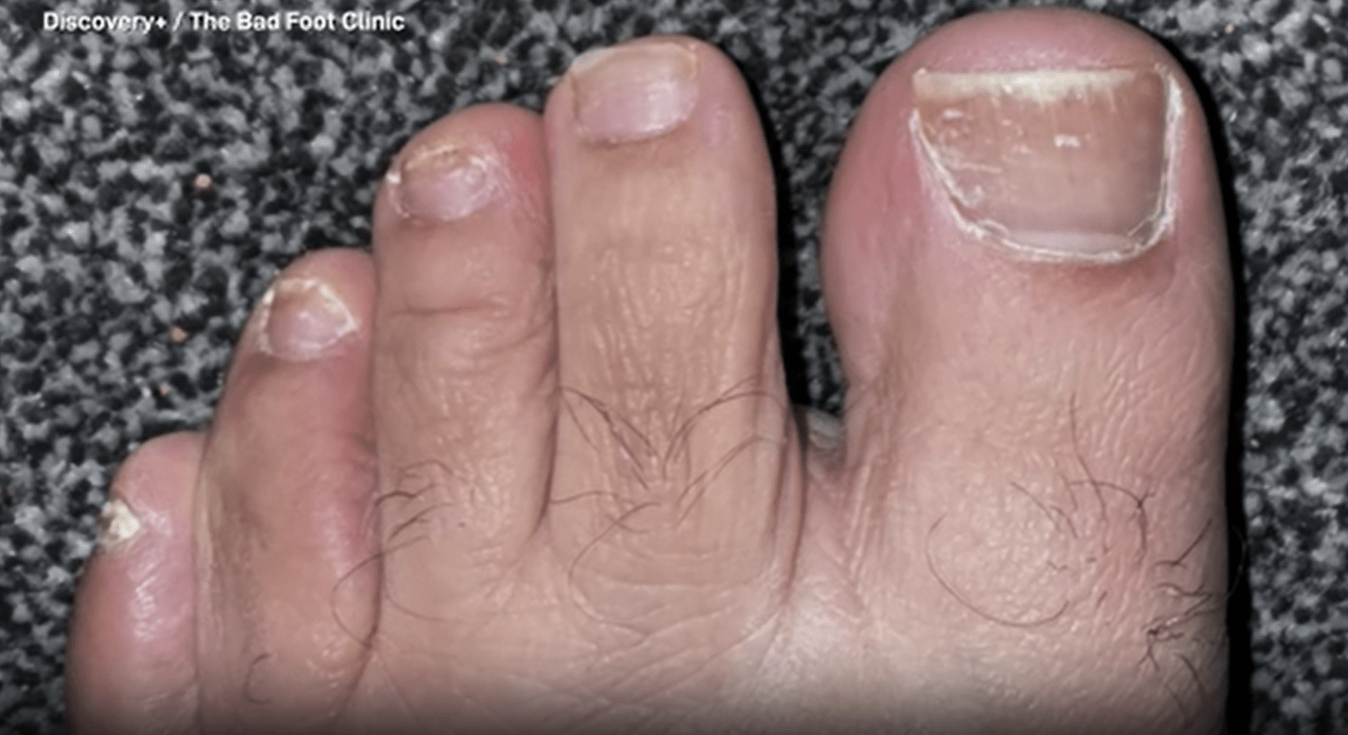 The Bad Foot Clinic